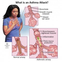 డాక్టర్  N.సంతోష్ కుమార్(PULMONOLOGY)